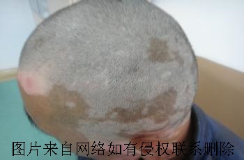 综ʳעʲô